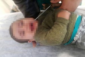 Antalya'da 9 aylık Muhammed'in ağzına kova demiri saplandı