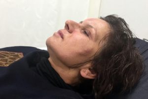 Park etme y&uuml;z&uuml;nden 51 yaşındaki &ouml;ğretmeni hastanelik etti