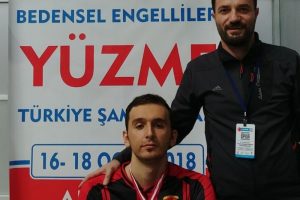 Y&uuml;zme sevdası y&uuml;z&uuml;nden sakat kaldı ama pes etmedi