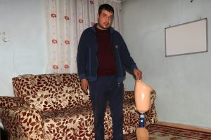 &Ouml;len eşinin protez bacağını bağışlamak istiyor