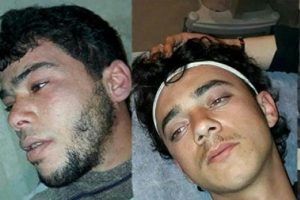 PKK/PYD, zehirli gazla saldırdı: 20 &Ouml;SO'lu zehirlendi