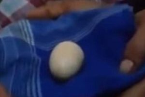 14 yaşındaki &ccedil;ocuk doktorların g&ouml;z&uuml; &ouml;n&uuml;nde 'yumurtladı'