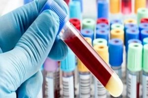 Molek&uuml;lden patente yerli kanser ilacı