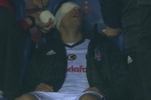 Beşiktaş'ta Adriano sakatlandı