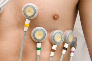 Bradiaritmi nedir? Ani kardiyak &ouml;l&uuml;m nedir?
