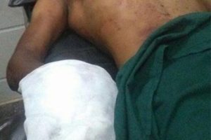 Kasap, porno bağımlısı oğlunun elini satırla kopardı