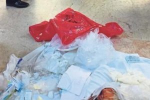 Akılalmaz skandal! Kopan parmak hastanede kayboldu