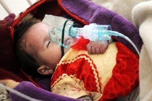 'Yemen'de 2017'de her g&uuml;n en az 5 &ccedil;ocuk &ouml;ld&uuml; ya da yaralandı'