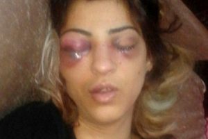 Barışmak istemeyen eşini &ouml;ld&uuml;resiye d&ouml;vd&uuml;!