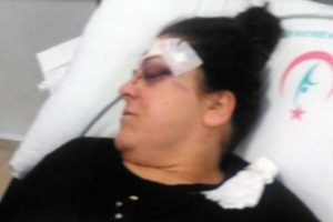 Eşine sokak ortasında tornavida ile saldırdı!