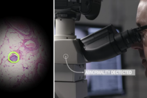 Kanseri teşhis edebilen akıllı mikroskop geliştirildi