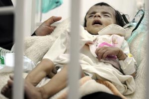 Yemen'de her yıl 66 bin çocuk ölüyor