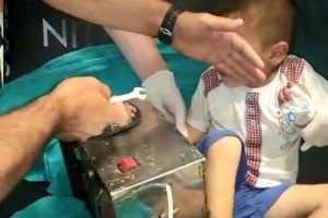 3 yaşındaki Ahmet elini kıyma makinesine kaptırdı!