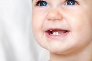Bebeklerde süt dişlerinin önemine dikkat