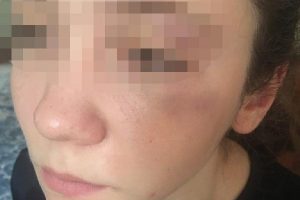 14 yaşındaki milli karateci 'dövüldü' iddiası