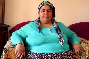 Kilolarından kurtulmak i&ccedil;in yardım bekliyor