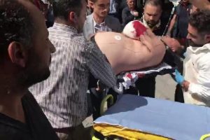 Kuyumcuda asans&ouml;r zemine &ccedil;akıldı: 1 yaralı
