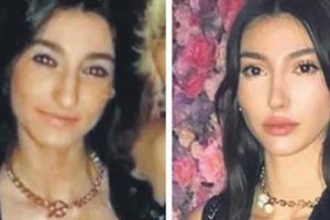 Miss Turkey g&uuml;zelinden şok s&ouml;zler: &Ouml;d&uuml;l doktorun hakkı!