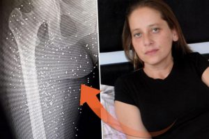 V&uuml;cudunda tam 600 tane var