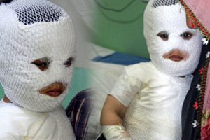 Akıl almaz rakam! 400'&uuml;n &uuml;zerinde kişi b&ouml;yle yandı