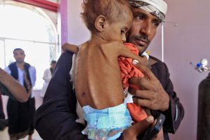 Yemen son 100 yılın en b&uuml;y&uuml;k kıtlık felaketi ile karşı karşıya