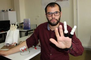 İki parmağını kaybeden öğrenci, kendine protez parmak yaptı