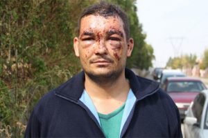 İnanılmaz kaza! Birden &ouml;n&uuml;ne &ccedil;ıktı ve...