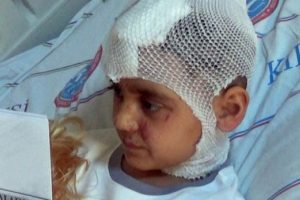 K&ouml;pek saldırısına uğrayan anne-kızdan iyi haber