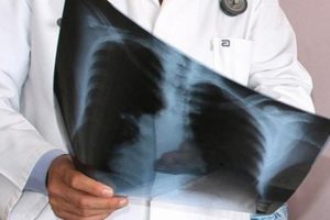 Bacaktan gelen &ouml;l&uuml;mc&uuml;l tehlike: Akciğer embolisi