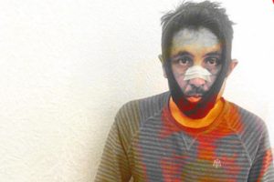 Akılalmaz olay! Dayanamadı, şikayet etti; &ouml;l&uuml;mden d&ouml;nd&uuml;...