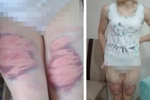 Kan donduran ifadeler: Herkes bilirdi, elleri y&uuml;z&uuml; hep mosmordu