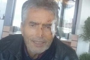 Bursa'da Alzheimer hastası 2 gündür kayıp