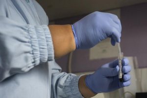 AIDS'ten &ouml;l&uuml;m oranı y&uuml;zde 40 azaldı
