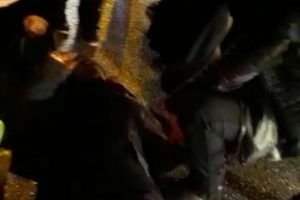 Bursa'da otomobilin çarpıp kaçtığı genç kadın yaralandı