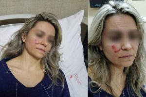 Doktora saldırmıştı, yakalandı! İfadesi şoke etti