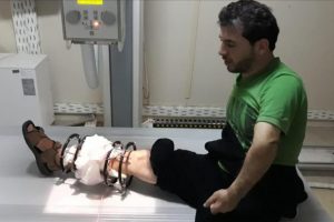 Saldırıda yaralanan eski Suriyeli futbolcuya yardım eli