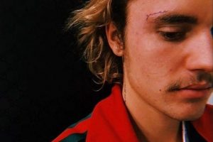 Justin Bieber y&uuml;z&uuml;ndeki yeni d&ouml;vme ile olay oldu