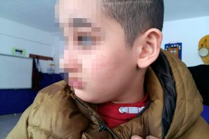 Otizmli &ouml;ğrenciye sınıfta &ouml;ğretmen şiddetine su&ccedil; duyurusu