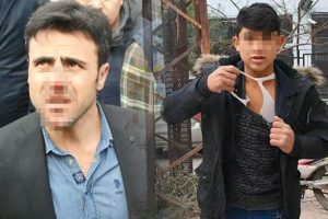 Seyyar satıcı zabıtanın burnunu kırdı