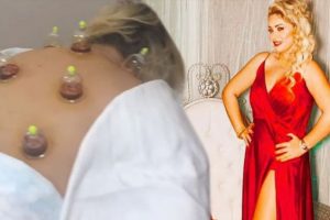 Yeliz Yeşilmen hacamat yaptırdı!