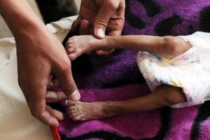 Yemen'de 6 bin 700'den fazla &ccedil;ocuk &ouml;ld&uuml; veya yaralandı