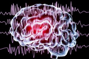 'Derin beyin stim&uuml;lasyonu' epilepsi tedavisinde umut olacak