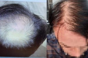 Sa&ccedil; ekiminden memnun kalmayan m&uuml;hendis dava a&ccedil;tı