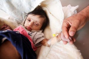 Yemen'de milyonlarca kişi sağlık hizmetlerinden mahrum