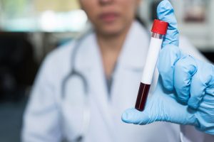 Hepatit C ile m&uuml;cadele s&uuml;r&uuml;yor! 30 milyon kişi kontrolden ge&ccedil;ti