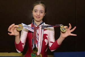 Down sendromlu S&uuml;meyye jimnastikle hayata tutundu