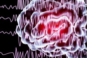 Epilepsi her yaşta ortaya &ccedil;ıkabilir