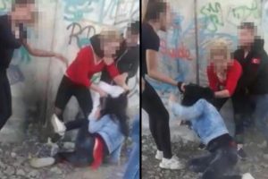 Feci şekilde d&ouml;v&uuml;p, o anları kaydetmişlerdi! Flaş gelişme