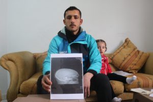 Kafasındaki mermiyle yaşam m&uuml;cadelesi veriyor