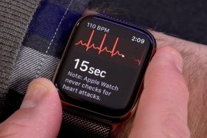 Apple Watch'un EKG &ouml;zelliği Avrupa'ya da geldi